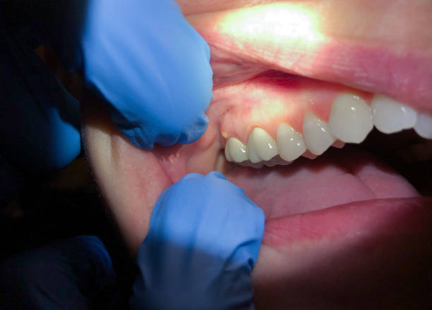 Best Emergency TMJ Treatment in Roosevelt Gardens, FL